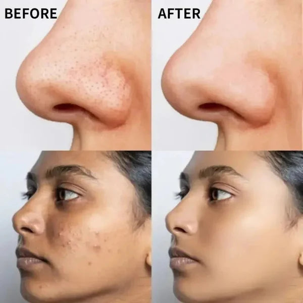 The Ordinary Vitamin C Suspension 30% in Silicone – Brightening Serum for Radiant, Even-Toned Skin (Imported Quality)