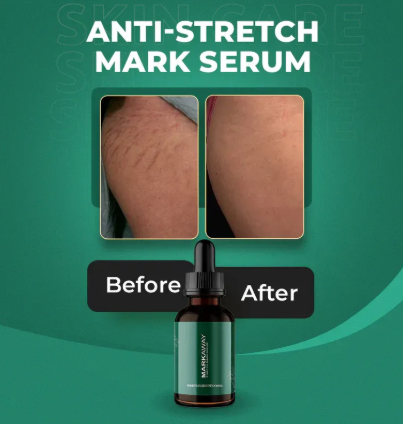 Markaway Stretch Mark Serum 30ml – Herbal Skin Repair & Firming